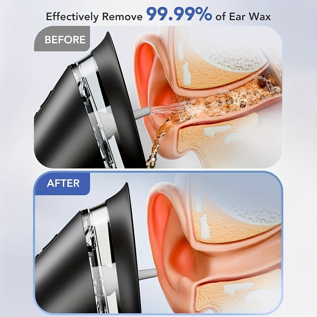 Electric Ear Wax Removal Kit – 3-Speed Hydraulic Ear Cleaner with Irrigation Flushing System & Wastewater Recovery, USB Rechargeable, Adults Home Use